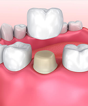 illustration of crowns