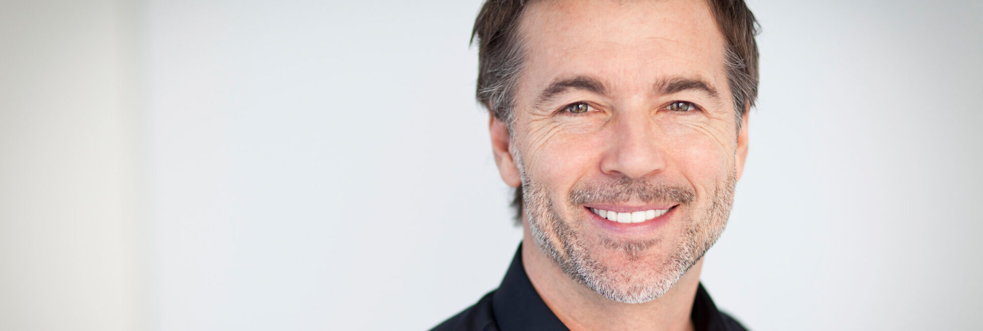 White man smiling and showing off dental veneers.