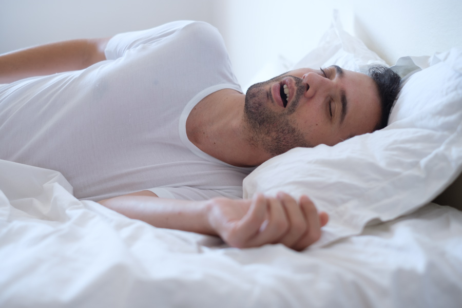 Man with obstructive sleep apnea snores while sleeping and needs a custom oral appliance