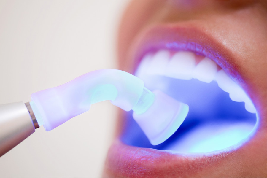 woman undergoing laser dentistry